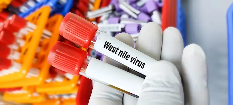 Présence du virus West Nile à Bordeaux confirmée